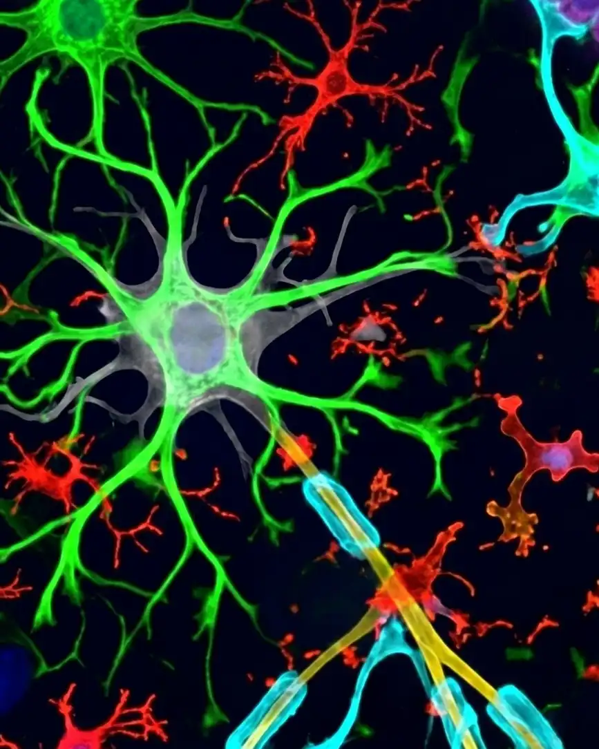 Fibromyalgie : le rôle des cellules gliales